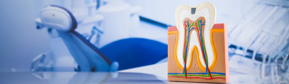 Signs You May Need A Root Canal: What To Watch For In Muncie IN